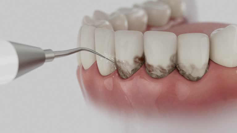 Reliable Wisdom Tooth Removal contractor in Rutherford County County, TN by Dentist Open Now
